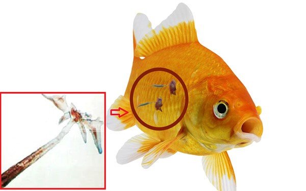 Triệu chứng và cách điều trị bệnh ký sinh trùng