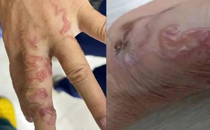Cá Ăn Giun Sán: Hiểu Rõ Mối Liên Hệ Để Bảo Vệ Sức Khỏe