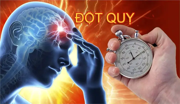 Ngăn Ngừa Đột Quỵ
