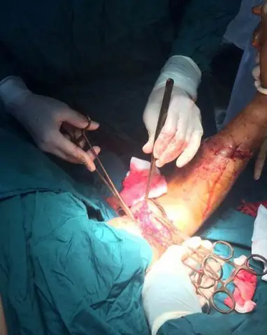 Cá Mập Tấn Công Ngư Dân Gây Đứt Động Mạch Ở Bạch Long Vĩ