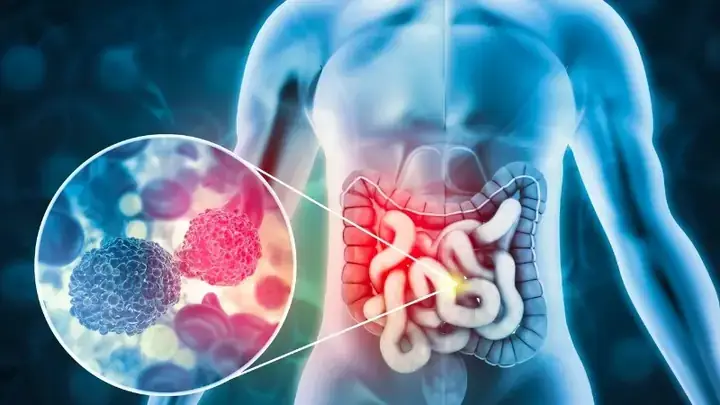 Không Nên Ăn Cá Cùng Thực Phẩm Gì?