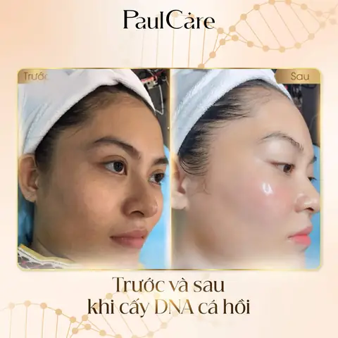 Làm Chậm Quá Trình Lão Hoá Của Da Làm Chậm Quá Trình Lão Hoá Của Da