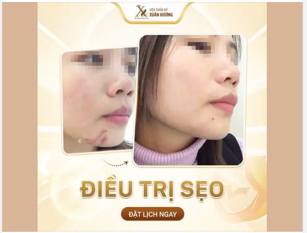 Sẹ Cá Là Gì? Toàn Cảnh Về Trứng Cá Chép Trong Tự Nhiên Và Nuôi Trồng