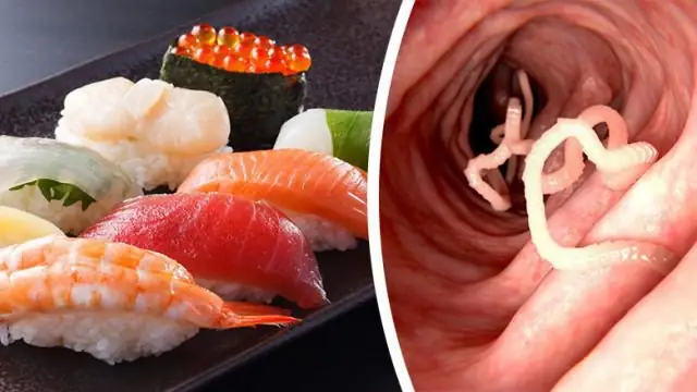 Nguyên Nhân Bệnh Sán Diphyllobothrium Và Sparganum